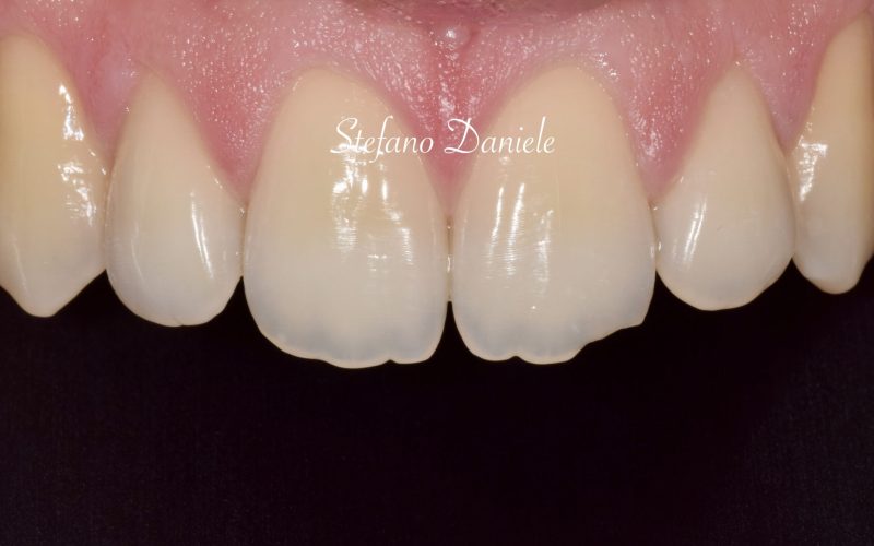 1) Odontoiatria conservativa anteriore