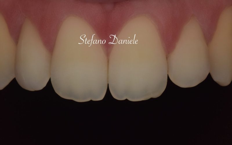5) Odontoiatria conservativa anteriore